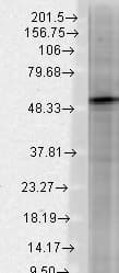 IHC-plus™ GABRB3 Antibody (clone S87-25)