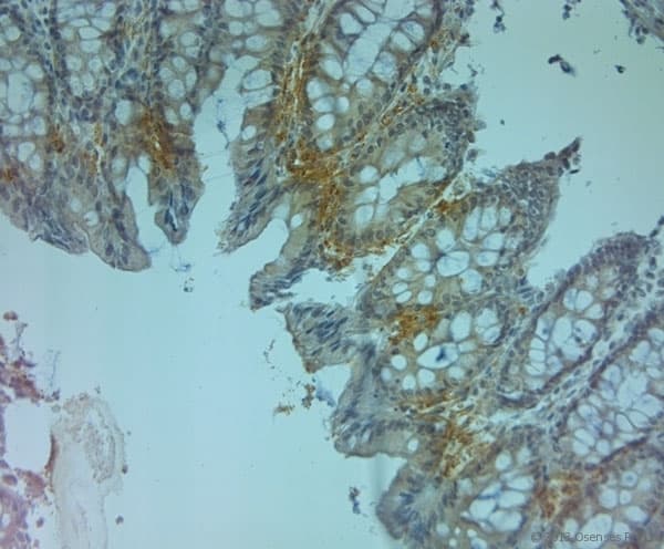 TJP2 / ZO2 / ZO-2 Antibody (aa740-790)