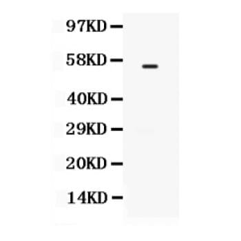 TGFBR1 / ALK5 Antibody (aa149-186)