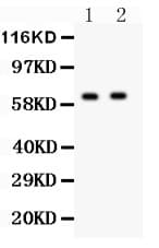 HEXB Antibody (aa381-556)