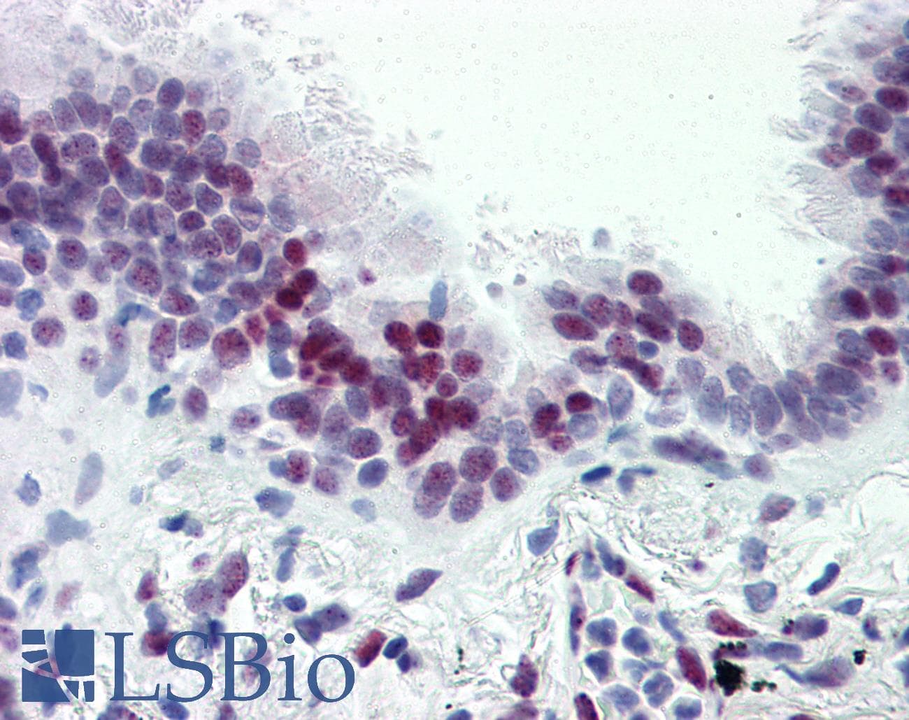 IHC-plus™ CASZ1 Antibody