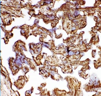 HSPB1 / HSP27 Antibody