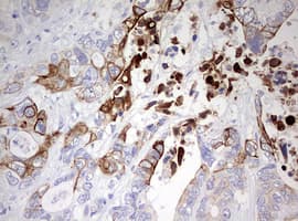 Monoclonal Mouse anti-Human KRT20 / CK20 / Cytokeratin 20 Antibody (clone OTI2A2, IHC, WB)