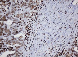 DCPS Antibody (clone OTI1E6)