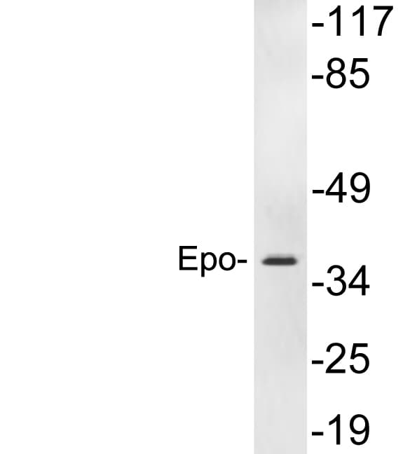 EPO / Erythropoietin Antibody (aa3-52)