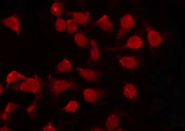 PNCK / CaMK1b Antibody