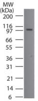 IHC-plus™ Polyclonal Rabbit anti-Human TMEM123 / Porimin Antibody (aa173-188, IHC, WB)