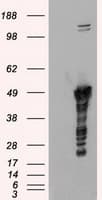 GFAP Antibody (clone OTI2F7)