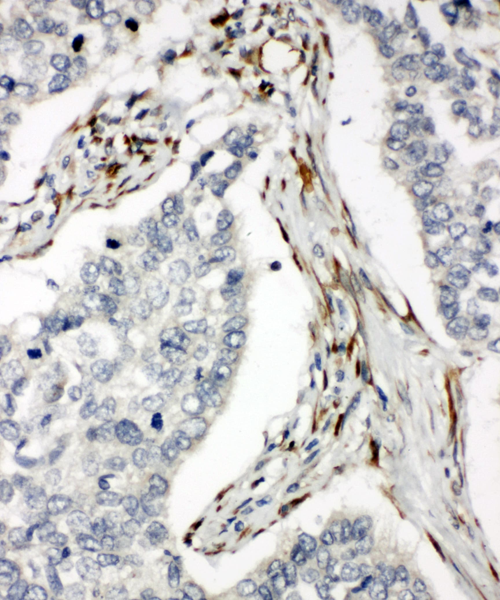 TNFRSF10B / Killer / DR5 Antibody (aa333-348)