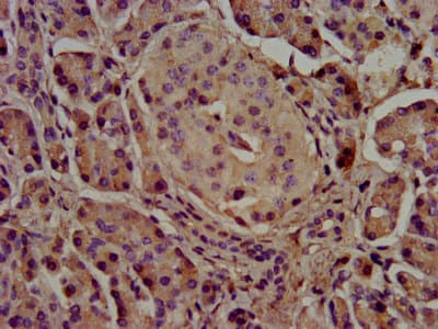 CEL / Carboxyl Ester Lipase Antibody