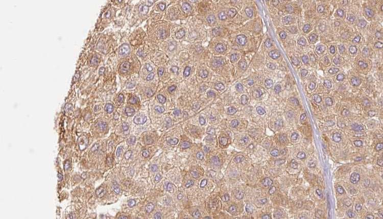Polyclonal Rabbit anti-Human PLAU / Urokinase / uPA Antibody (IHC, WB)