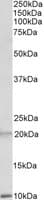 IHC-plus™ Polyclonal Goat anti-Human DEFA1 / Defensin Alpha 1 Antibody (aa50-63, IHC, WB)