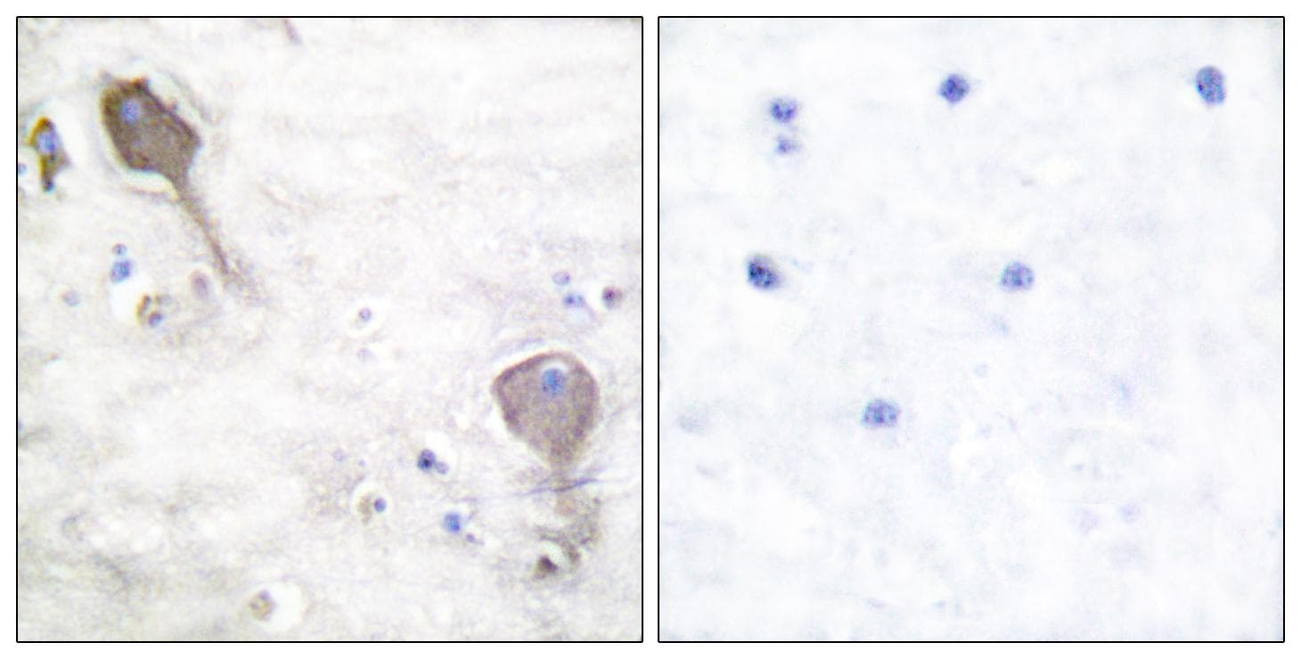 Polyclonal Rabbit anti-Human PARK2 / Parkin 2 Antibody (IHC, WB)