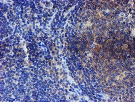 ER Alpha / Estrogen Receptor Antibody (clone OTI1B1)