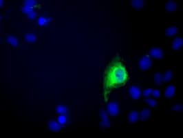 C9orf41 Antibody (clone OTI6E4)