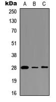 BCAP31 / BAP31 Antibody (Internal)