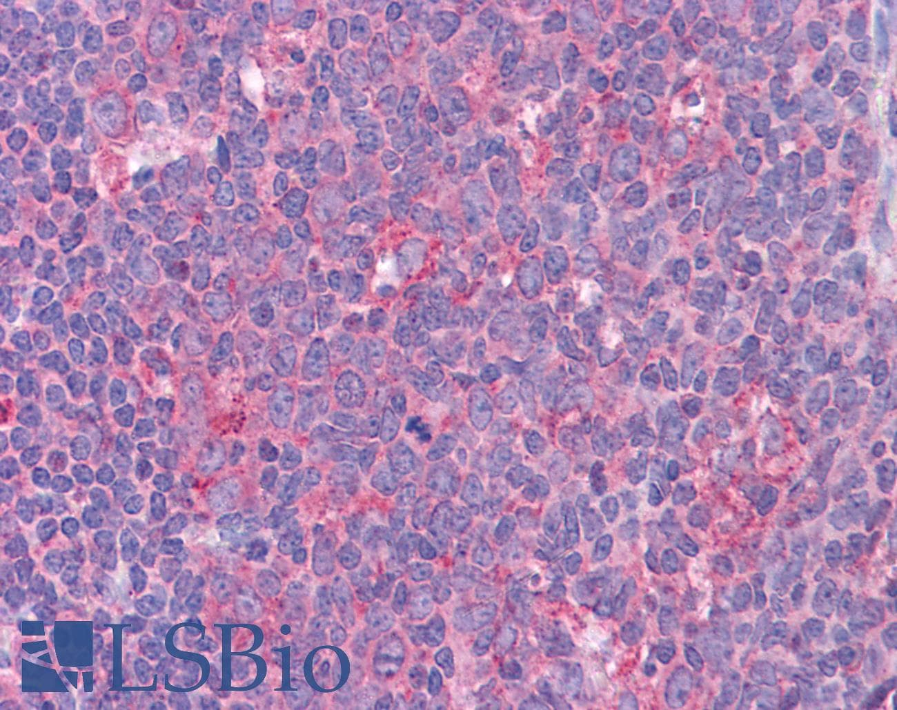 Polyclonal Rabbit anti-Human STAT6 Antibody (aa614-663, IHC, WB)