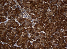 NME1 / NM23 Antibody (clone OTI1A12)