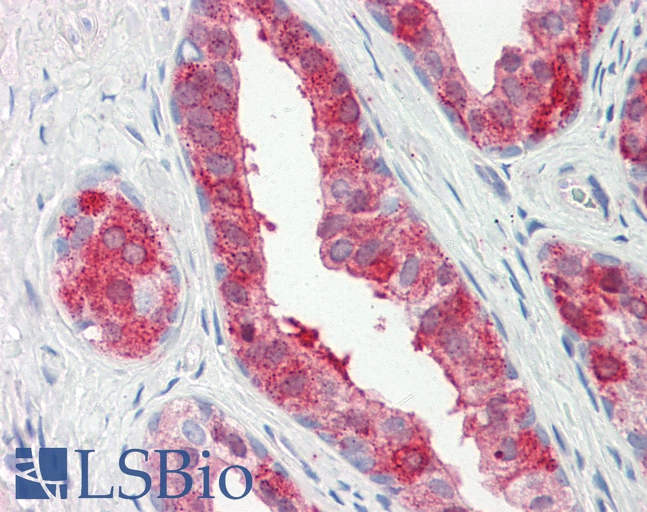 Polyclonal Rabbit anti-Human PTGES2 Antibody (IHC, WB)