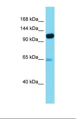 Polyclonal Rabbit anti-Human PITRM1 / MP1 Antibody (aa88-137, WB)