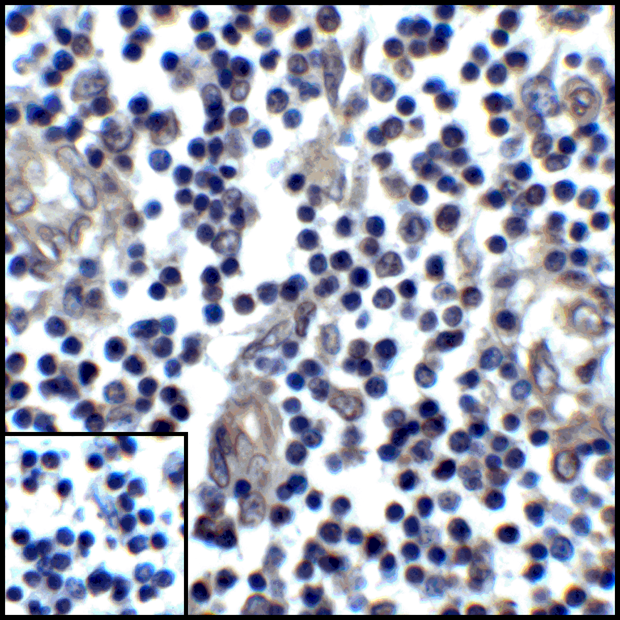 CD274 / B7-H1 / PD-L1 Antibody (clone 6H10)