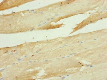 UQCR10 / UCRC Antibody