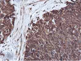 PSMB7 Antibody (clone OTI1E1)