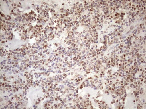 MGMT Antibody (clone OTI4F9)
