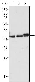 KRT17 / CK17 / Cytokeratin 17 Antibody (clone 3B12)