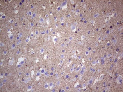 NCAM / CD56 Antibody (aa20-718, clone OTI2B9)