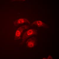MAPK14 / p38 Antibody (Internal)