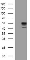 MMP13 Antibody (aa104-471, clone OTI1G5)