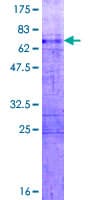 Human HOXA11 Protein (Recombinant GST)