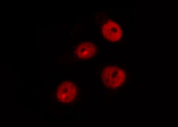 RB1 / Retinoblastoma / RB Antibody