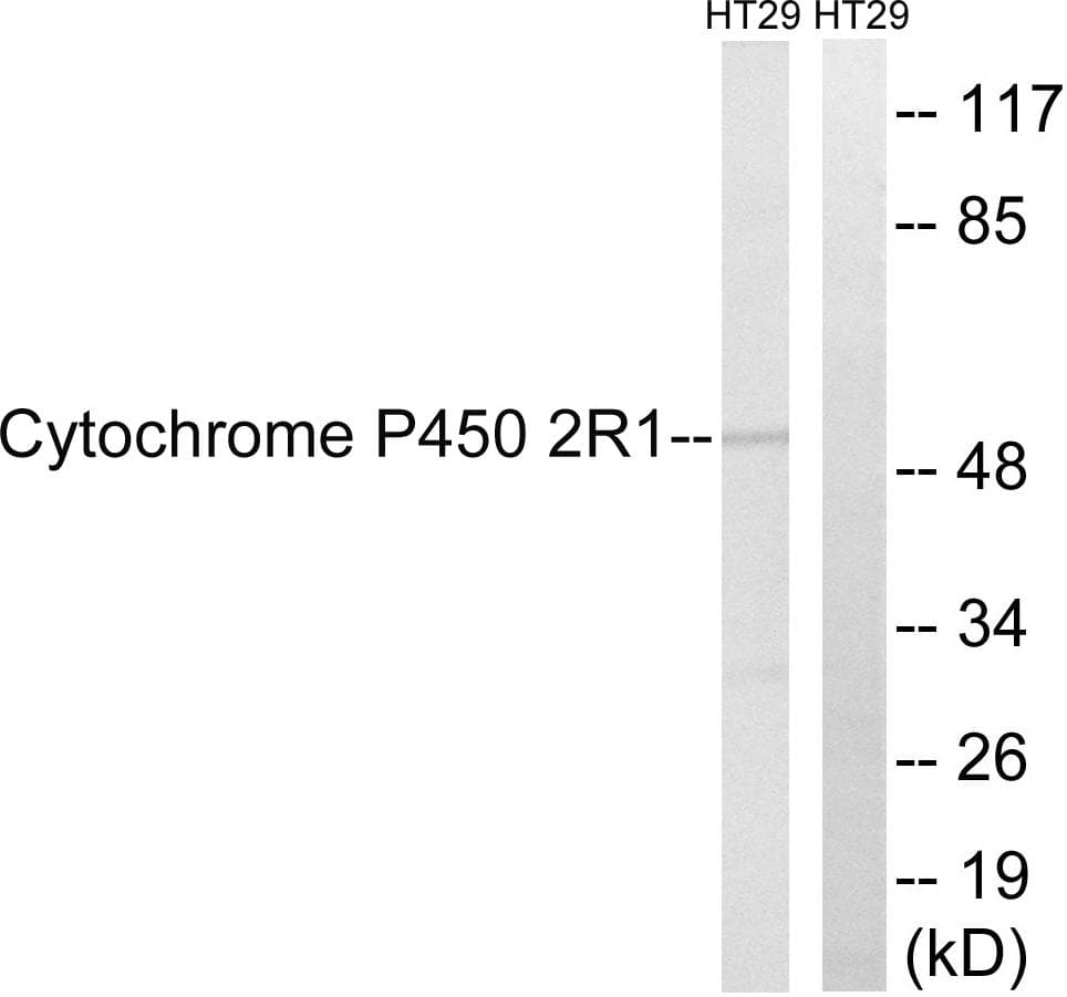 Polyclonal Rabbit anti-Human Cytochrome P450 2R1 / CYP2R1 Antibody (IF, WB)