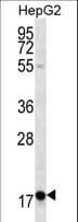 RPL15 / Ribosomal Protein L15 Antibody (aa21-50)