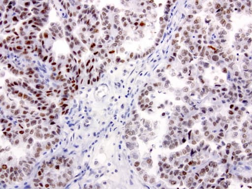 XRCC1 Antibody (clone UMAB40, Carrier-free)