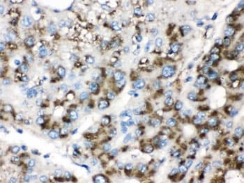 Polyclonal Rabbit anti-Human CAT / Catalase Antibody (IHC, WB)
