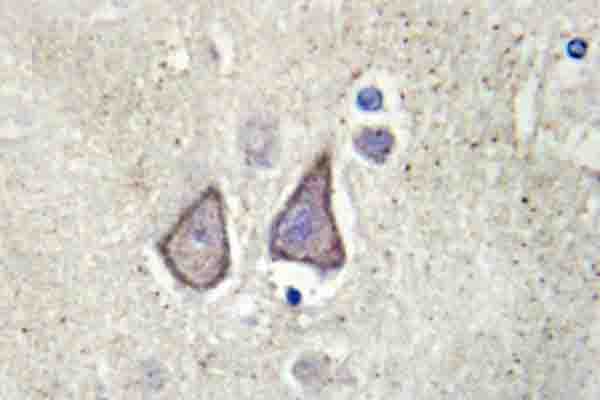 CDH9 / Cadherin 9 Antibody (Pro222)