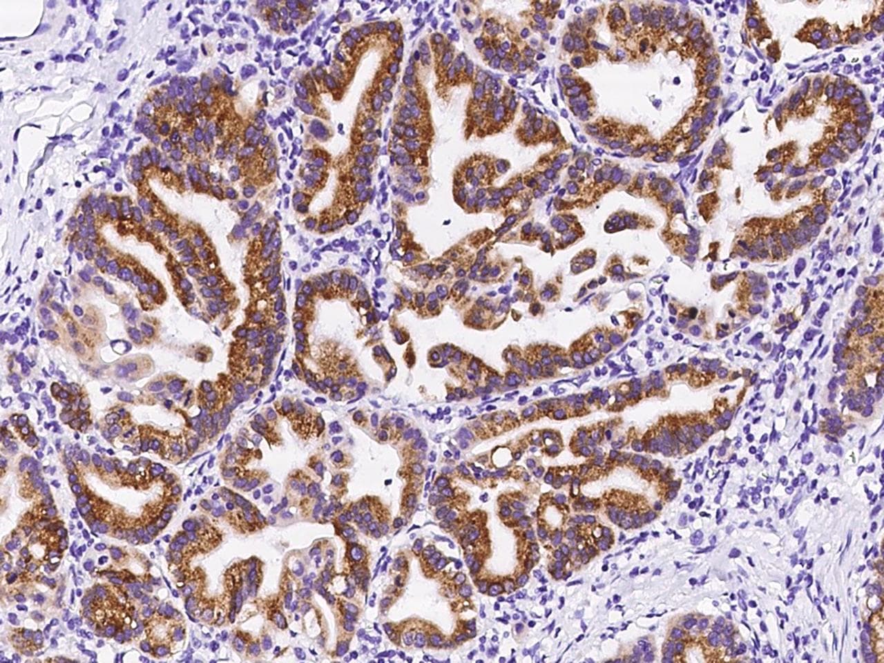 OPHN1 Antibody