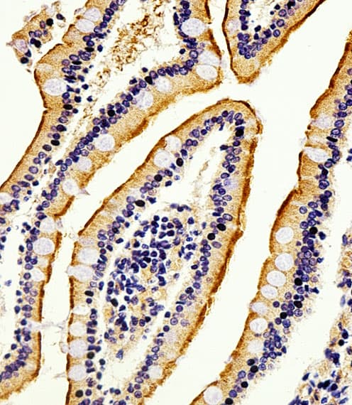 ALPI / Alkaline Phosphatase Antibody (aa274-304)