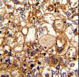 Complement C6 Antibody (aa30-58)