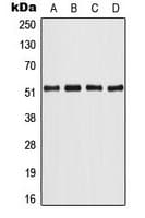 Polyclonal Rabbit anti-Human ATF2 Antibody (Internal, IHC, WB)