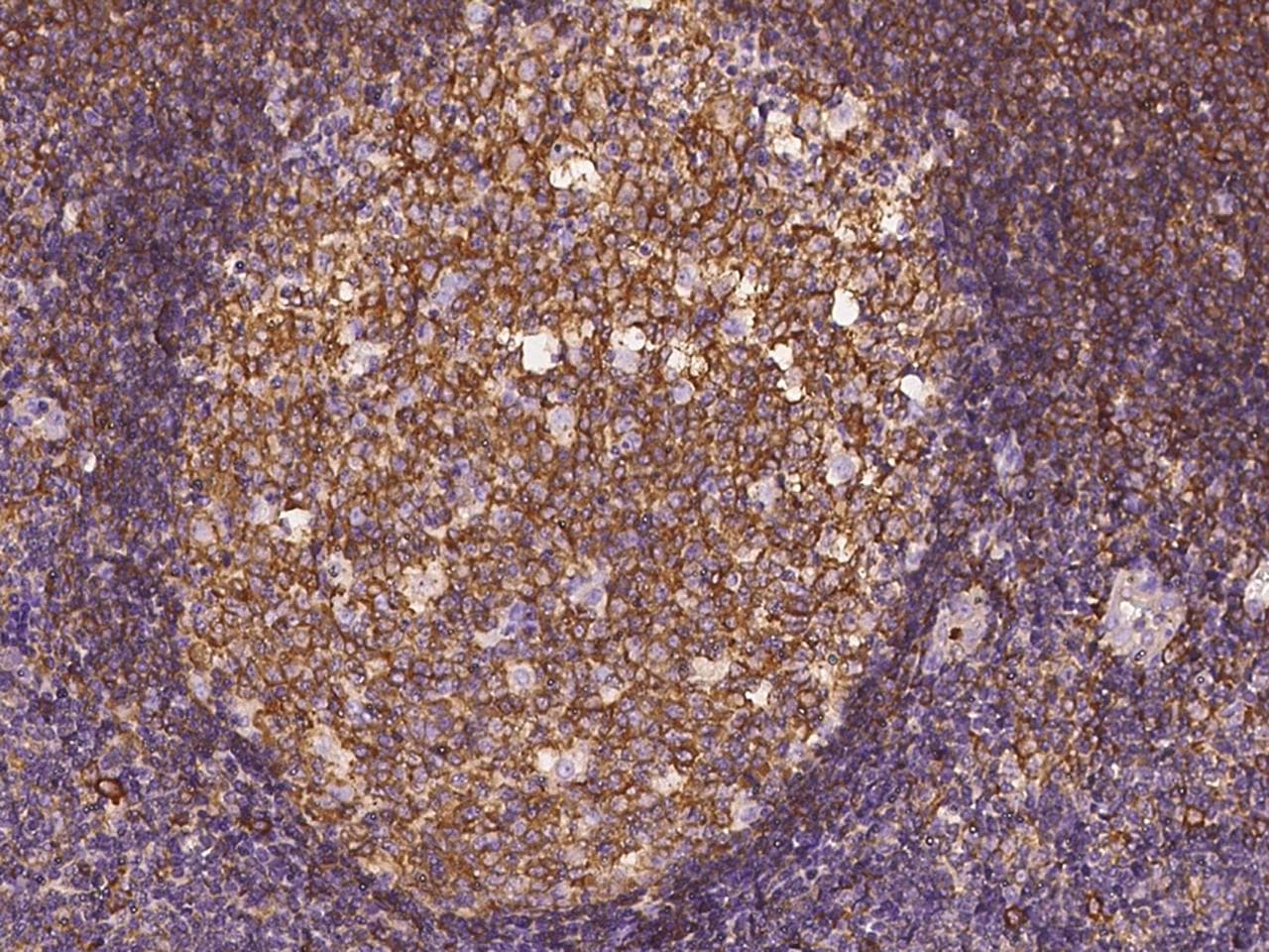 VASP Antibody