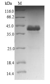 Human NDUFA12 / B17.2 Protein (Recombinant GST, N-terminus)