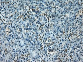 NOTCH1 Antibody (clone OTI3E12)