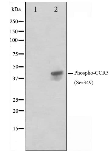 Polyclonal Rabbit anti-Human CCR5 Antibody (phospho-Ser349, IF, WB)