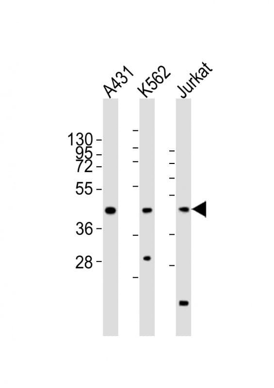 RBMX Antibody (aa222-252)