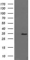 SYP / Synaptophysin Antibody (clone OTI1G6)