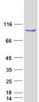 Human IREB2 / IRP2 Protein (Recombinant Myc-DDK (Flag))